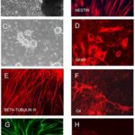 stem_cells_nose