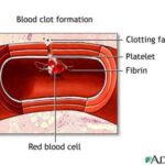 blood-clot-formation