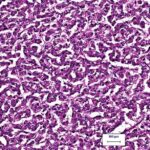 cellule_pancreatiche