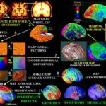 MRI_3D