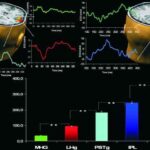EEG_TMS
