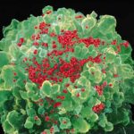 HIV