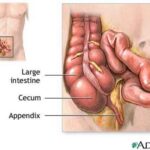 appendice
