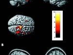 brain_concentration