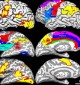 fMRI