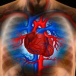 heart-disease