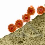 herpes_simplex
