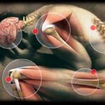 terapia_del_dolore