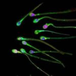 Sperm