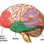 alzheimer