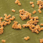 staphilococcus_aureus