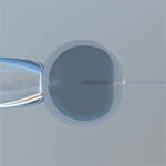 fertilita