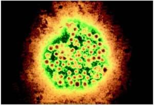 hepatitis-a hepatitis a 300x205 Epidemia Epatite A, ed è allarme alimenti