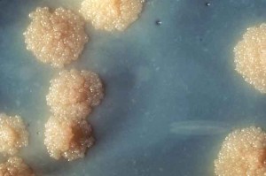 tubercolosi tubercolosi 300x199 Tubercolosi: sarà una strategia mondiale a sviluppare un vaccino