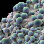 Prostate_cancer_cells
