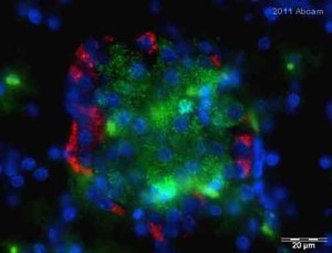 glucagone glucagone 300x229 Diabete di tipo 2, altra risorsa per curarlo arriva dal glucagone