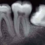radiografie_dentali