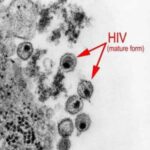 HIV
