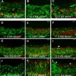 fibroblasti