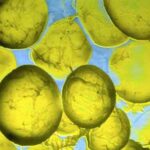 grasso_cellule