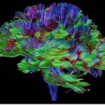 EEG