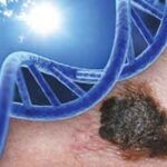 Melanomoa_DNA_UV
