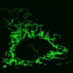 Proteins-Alzheimer
