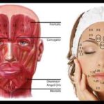botox