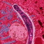 malaria