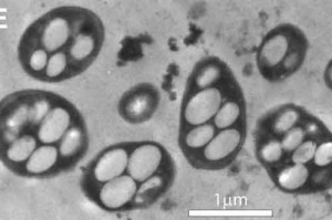 HalomonasGFAJ 1 300x199 Smentita la bufala del batterio allarsenico