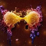 Prostate_Cancer_cell