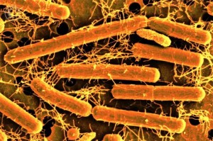 bacteria that cause tooth decay 300x199 Scoperta molecola che contrasta i batteri che causano la carie
