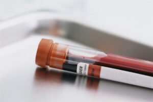 bloodtest 300x200 FDA pone il suo OK sul test rapido che rileva infezioni nel sangue