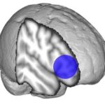 brain-anxiety-study1