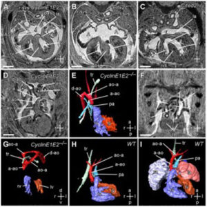 cardiac development 300x300 Sviluppo cardiaco nellembrione: scienziati trovano la proteina chiave