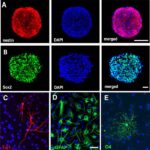 cellule_neurali_progenitric