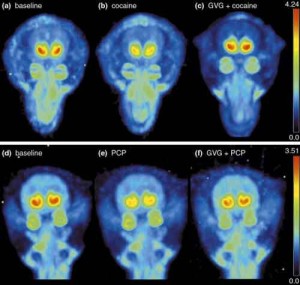 dopamina 300x285 Cervello: dopamina riduce impulsività
