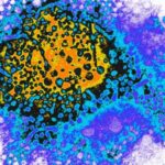 hepatitis-b-virus