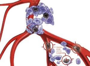Cancer StemCells 300x220 Recidiva tumori dopo le cure: responsabili gruppo di cellule staminali