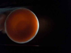 EPO 300x224 EPO: utilizzo a lungo termine e danni al midollo osseo