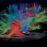 brain_imaging