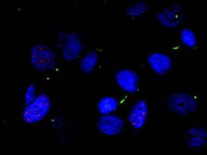 crel protein 300x225 Morbo di Parkinson: scoperta proteina sentinella che protegge il cervello