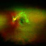 optomap-image