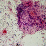 pregnancy_bacteria
