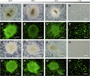 stem cells 300x256 La Procura di Torino indaga la Stamina Foundation, e vengono sospese le cure, unica speranza di vita, a Celeste, bambina malata di Atrofia Muscolare