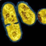 propionibacterium_acnes