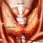 ca_thyroid