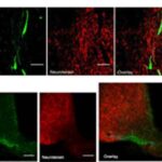 neurotensina