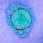 Hendra-Virus