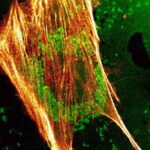bonemarrow-stem-cells